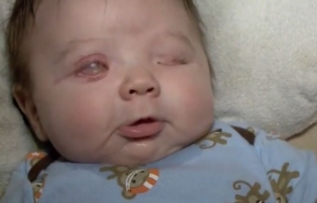 shocking-babies-are-now-being-born-without-eyes-a-sign-of-the-end